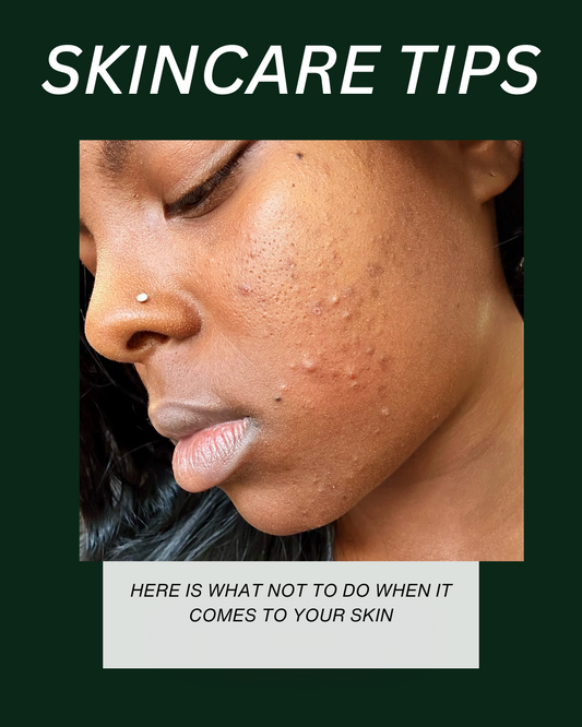 Skincare Don’ts