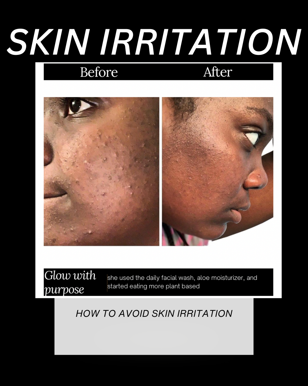 How To Prevent Irritation