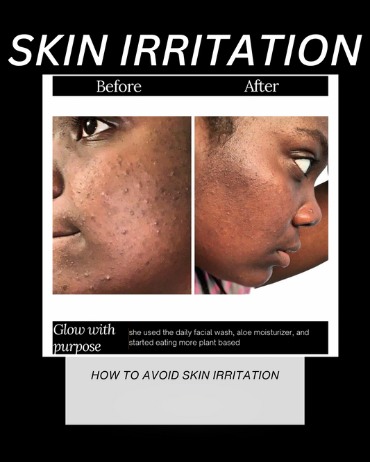 How To Prevent Irritation